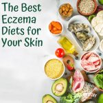 Eczema diets itchylittleworld